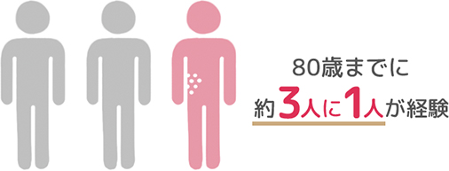 80歳までに約3人に1人が経験
